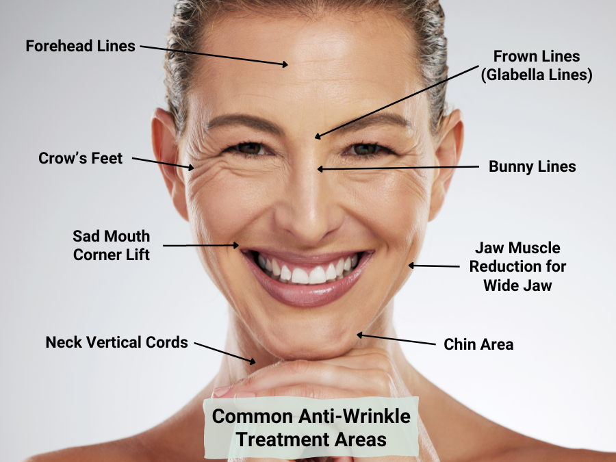 ANTI-WRINKLE INJECTIONS