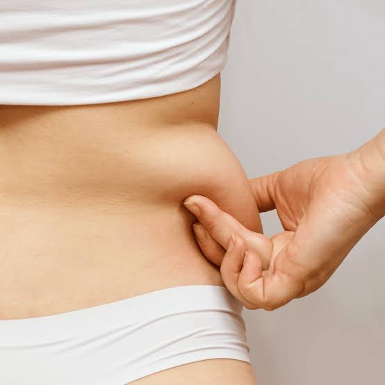 FAT FREEZING — CRYOLIPOLYSIS