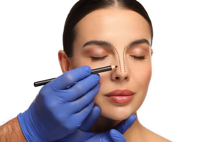 LIQUID RHINOPLASTY — NON-SURGICAL NOSE RESHAPING