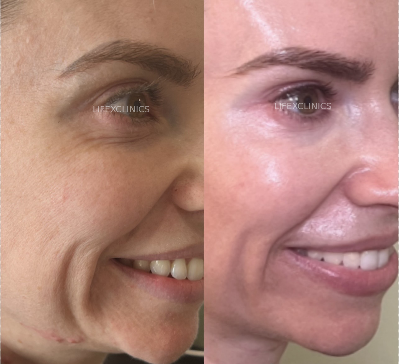 Before & After