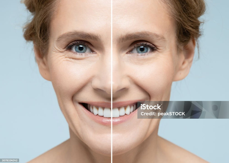 Before and After Sample Image