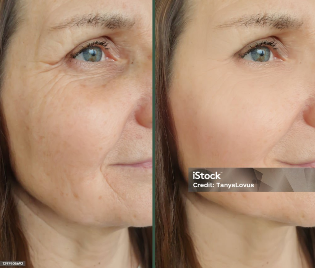 Before and After Sample Image